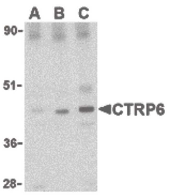C1QTNF6 / CTRP6 Antibody - Western blot of CTRP6 in mouse brain cell lysate with CTRP6 antibody at (A) 0.5, (B) 1 and (C) 2 ug/ml.