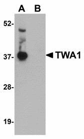 C20orf11 / TWA1 Antibody - Western blot of TWA1 in human brain tissue lysate with TWA1 antibody at 1 ug/ml in (A) the absence and (B) the presence of blocking peptide. 