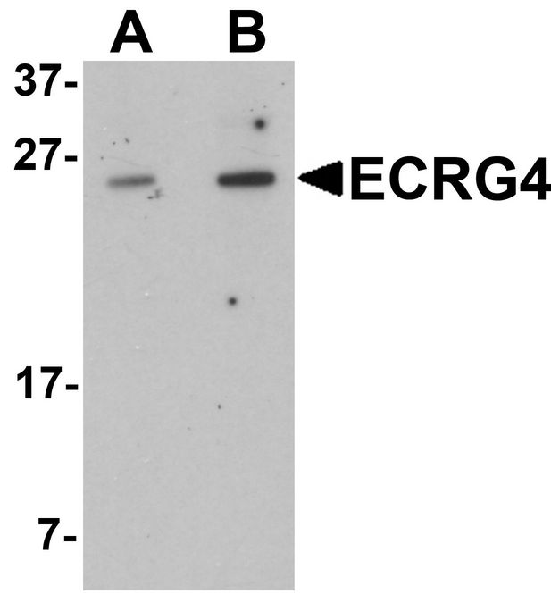 C2orf40 / ECRG4 Antibody - Western blot analysis of ECRG4 in HeLa cell lysate with ECRG4 antibody at (A) 1 and (B) 2 ug/ml.