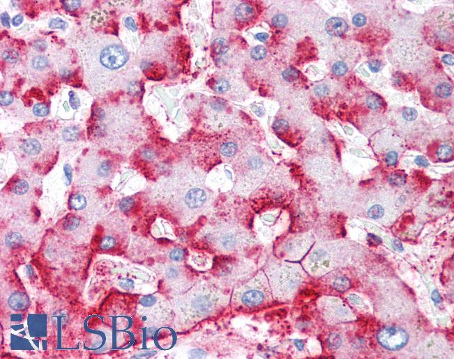 C4BP / C4b-Binding Protein Antibody - Anti-C4BP / C4b-Binding Protein antibody IHC of human liver. Immunohistochemistry of formalin-fixed, paraffin-embedded tissue after heat-induced antigen retrieval. Antibody concentration 5 ug/ml.