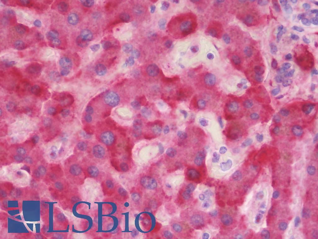 C4BPA / C4BP Alpha Antibody - Anti-C4BPA / C4BP antibody IHC staining of human liver. Immunohistochemistry of formalin-fixed, paraffin-embedded tissue after heat-induced antigen retrieval. Antibody dilution 1:100.