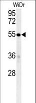 C4BPA / C4BP Alpha Antibody - C4BPA Antibody western blot of WiDr cell line lysates (35 ug/lane). The C4BPA antibody detected the C4BPA protein (arrow).