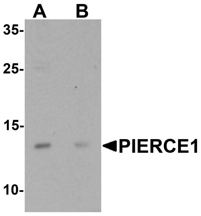C9orf116 Antibody - Western blot analysis of PIERCE1 in A20 cell lysate with PIERCE1 antibody at 1 ug/ml in (A) the absence and (B) the presence of blocking peptide.