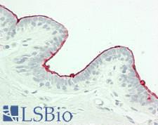 CA 15-3 Antibody - Human Breast: Formalin-Fixed, Paraffin-Embedded (FFPE)