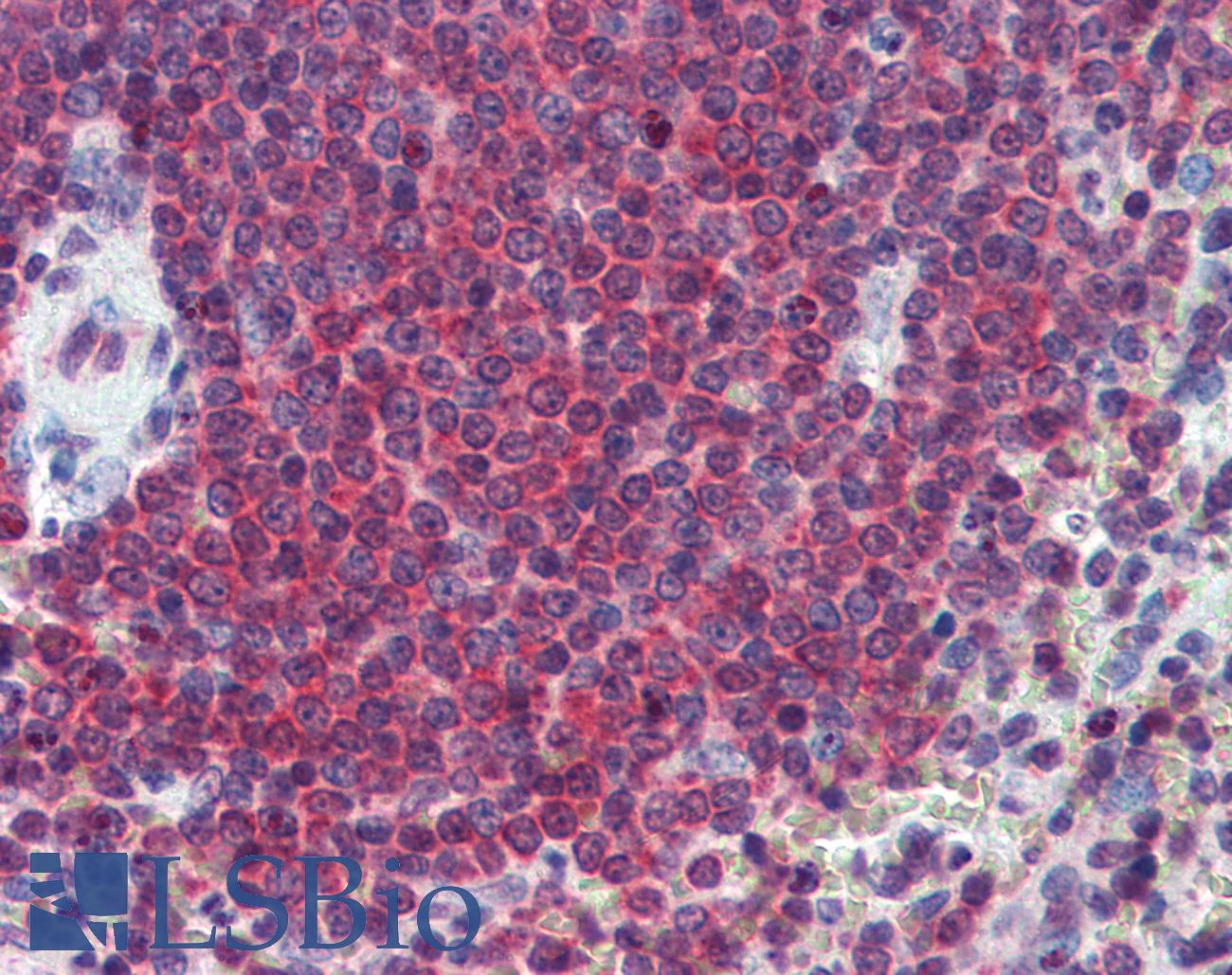 CA1 / Carbonic Anhydrase I Antibody - Anti-CA1 / Carbonic Anhydrase I antibody IHC of human spleen. Immunohistochemistry of formalin-fixed, paraffin-embedded tissue after heat-induced antigen retrieval. Antibody concentration 2.5 ug/ml.