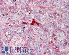 CA1 / Carbonic Anhydrase I Antibody - Anti-CA1 / Carbonic Anhydrase I antibody IHC of human spleen. Immunohistochemistry of formalin-fixed, paraffin-embedded tissue after heat-induced antigen retrieval. Antibody dilution 10 ug/ml.