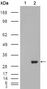 CA1 / Carbonic Anhydrase I Antibody - Western blot using CA1 mouse monoclonal antibody against HEK293T cells transfected with the pCMV6-ENTRY control (1) and pCMV6-ENTRY CA1 cDNA (2).