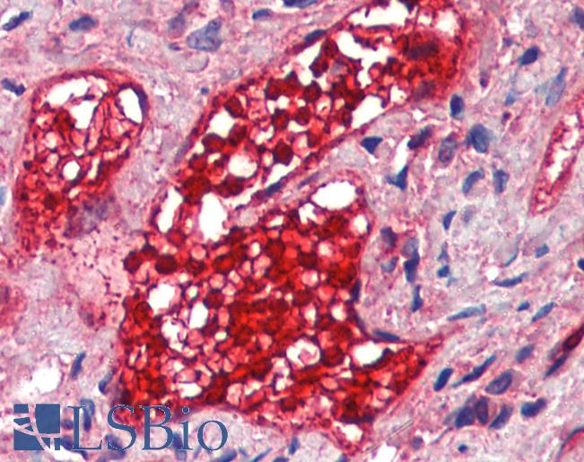 CA1 / Carbonic Anhydrase I Antibody - Anti-CA1 / Carbonic Anhydrase I antibody IHC of human vessel, red blood cells. Immunohistochemistry of formalin-fixed, paraffin-embedded tissue after heat-induced antigen retrieval. Antibody dilution 1:200.