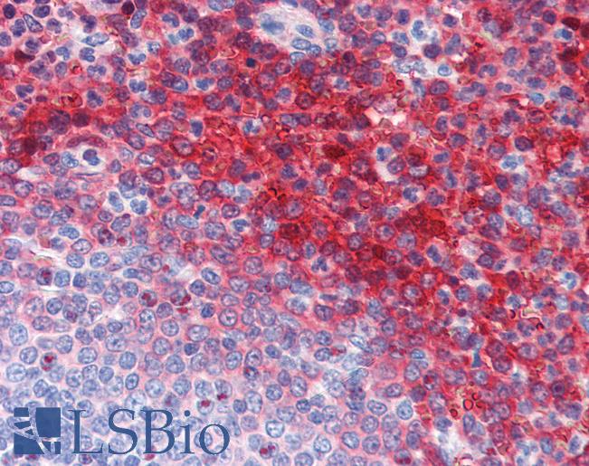 CA1 / Carbonic Anhydrase I Antibody - Anti-CA1 / Carbonic Anhydrase I antibody IHC of human spleen. Immunohistochemistry of formalin-fixed, paraffin-embedded tissue after heat-induced antigen retrieval. Antibody dilution 1:200.