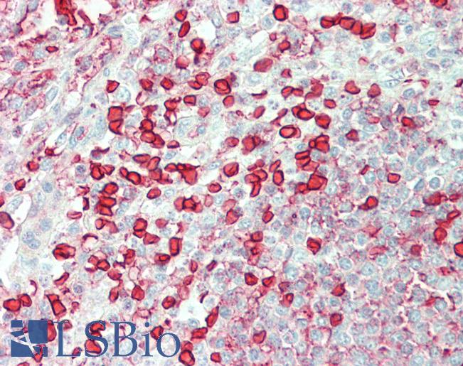 CA1 / Carbonic Anhydrase I Antibody - Anti-CA1 / Carbonic Anhydrase I antibody IHC staining of human spleen. Immunohistochemistry of formalin-fixed, paraffin-embedded tissue after heat-induced antigen retrieval. Antibody concentration 5 ug/ml.