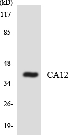 CA12 / Carbonic Anhydrase XII Antibody - Western blot analysis of the lysates from COLO205 cells using CA12 antibody.