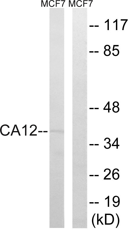 CA12 / Carbonic Anhydrase XII Antibody - Western blot analysis of lysates from MCF-7 cells, using CA12 Antibody. The lane on the right is blocked with the synthesized peptide.