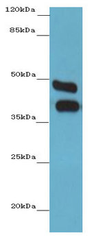 CA12 / Carbonic Anhydrase XII Antibody - CA12 antibody at 6ug/ml+Mouse kidney tissue Goat polyclonal to rabbit IgG at 1/10000 dilution