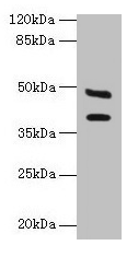 CA12 / Carbonic Anhydrase XII Antibody - Western blot All lanes: CA12 antibody at 6µg/ml + Mouse kidney tissue Secondary Goat polyclonal to rabbit IgG at 1/10000 dilution Predicted band size: 40, 39 kDa Observed band size: 40, 48 kDa