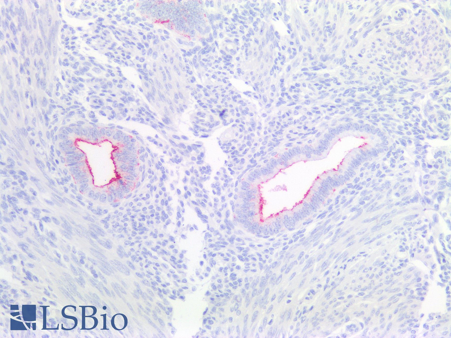 CA125 Antibody - Human Uterus, Endometrium: Formalin-Fixed, Paraffin-Embedded (FFPE)