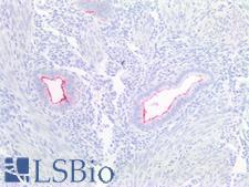 CA125 Antibody - Human Uterus, Endometrium: Formalin-Fixed, Paraffin-Embedded (FFPE)