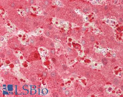 CA2 / Carbonic Anhydrase II Antibody - Human Liver: Formalin-Fixed, Paraffin-Embedded (FFPE)