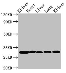 CA2 / Carbonic Anhydrase II Antibody - Western Blot Positive WB detected in: Rat kidney tissue, Rat heart tissue, Rat liver tissue, Mouse lung tissue, Mouse kidney tissue All lanes: CA2 antibody at 2µg/ml Secondary Goat polyclonal to rabbit IgG at 1/50000 dilution Predicted band size: 30 kDa Observed band size: 30 kDa