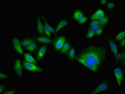 CA2 / Carbonic Anhydrase II Antibody - Immunofluorescent analysis of Hela cells using CA2 Antibody at dilution of 1:100 and Alexa Fluor 488-congugated AffiniPure Goat Anti-Rabbit IgG(H+L)