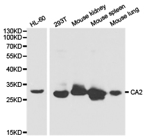 CA2 / Carbonic Anhydrase II Antibody - Western blot of extracts of various cell lines, using CA2 antibody.