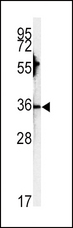 CA3 / Carbonic Anhydrase III Antibody - Western blot of CA3 antibody in HepG2 cell line lysates (35 ug/lane). CA3 (arrow) was detected using the purified antibody.