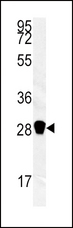 CA3 / Carbonic Anhydrase III Antibody - Western blot of CA3 antibody in mouse kidney tissue lysates (35 ug/lane). CA3 (arrow) was detected using the purified antibody.