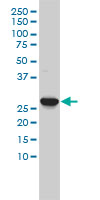 CA3 / Carbonic Anhydrase III Antibody - Western blot of CA3 expression in K-562 by CA3 monoclonal antibody (M02), clone 4A12-1A3.