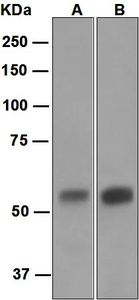 CA9 / Carbonic Anhydrase IX Antibody - Western blot analysis on (A) HT-29 and (B) human stomach lysates using anti-Carbonic Anhydrase 9 antibody.
