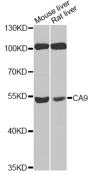 CA9 / Carbonic Anhydrase IX Antibody - Western blot analysis of extracts of various cell lines, using CA9 antibody at 1:100 dilution. The secondary antibody used was an HRP Goat Anti-Rabbit IgG (H+L) at 1:10000 dilution. Lysates were loaded 25ug per lane and 3% nonfat dry milk in TBST was used for blocking. An ECL Kit was used for detection and the exposure time was 30s.