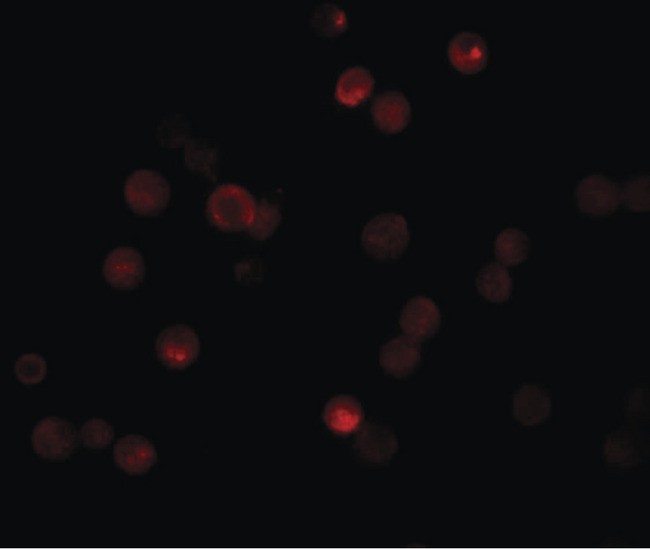 CABP7 Antibody - Immunofluorescence of CABP7 in HeLa cells with CAPB7 antibody at 20 ug/ml.