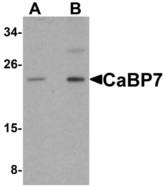 CABP7 Antibody - Western blot analysis of CaBP7 in HeLa cell lysate with CaBP7 antibody at (A) 1 and (B) 2 ug/ml.