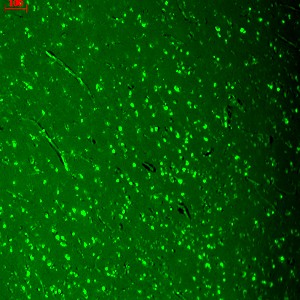 CACNA1D / Cav1.3 Antibody - Cav1.3 (S48A-9), Human hippocampus.  This image was taken for the unconjugated form of this product. Other forms have not been tested.