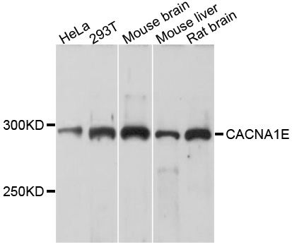 CACNA1E / Cav2.3 Antibody - Western blot analysis of extracts of various cell lines, using CACNA1E antibody at 1:1000 dilution. The secondary antibody used was an HRP Goat Anti-Rabbit IgG (H+L) at 1:10000 dilution. Lysates were loaded 25ug per lane and 3% nonfat dry milk in TBST was used for blocking. An ECL Kit was used for detection and the exposure time was 30s.