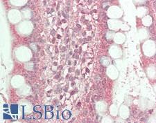 CACNB2 Antibody - Human Small Intestine: Formalin-Fixed, Paraffin-Embedded (FFPE)