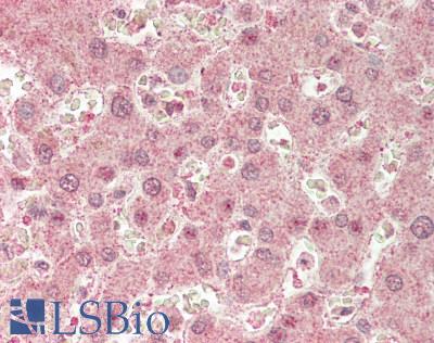 CACNB2 Antibody - Human Liver: Formalin-Fixed, Paraffin-Embedded (FFPE)