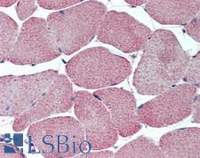CACNG1 / CACNG Antibody - Human Skeletal Muscle: Formalin-Fixed, Paraffin-Embedded (FFPE)