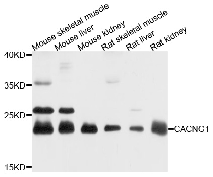 CACNG1 / CACNG Antibody - Western blot analysis of extracts of various cell lines, using CACNG1 antibody at 1:1000 dilution. The secondary antibody used was an HRP Goat Anti-Rabbit IgG (H+L) at 1:10000 dilution. Lysates were loaded 25ug per lane and 3% nonfat dry milk in TBST was used for blocking. An ECL Kit was used for detection and the exposure time was 10s.
