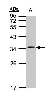 CACNG5 Antibody - Sample(30 ug whole cell lysate). A: Hep G2. 12% SDS PAGE. CACNG5 antibody diluted at 1:1000.