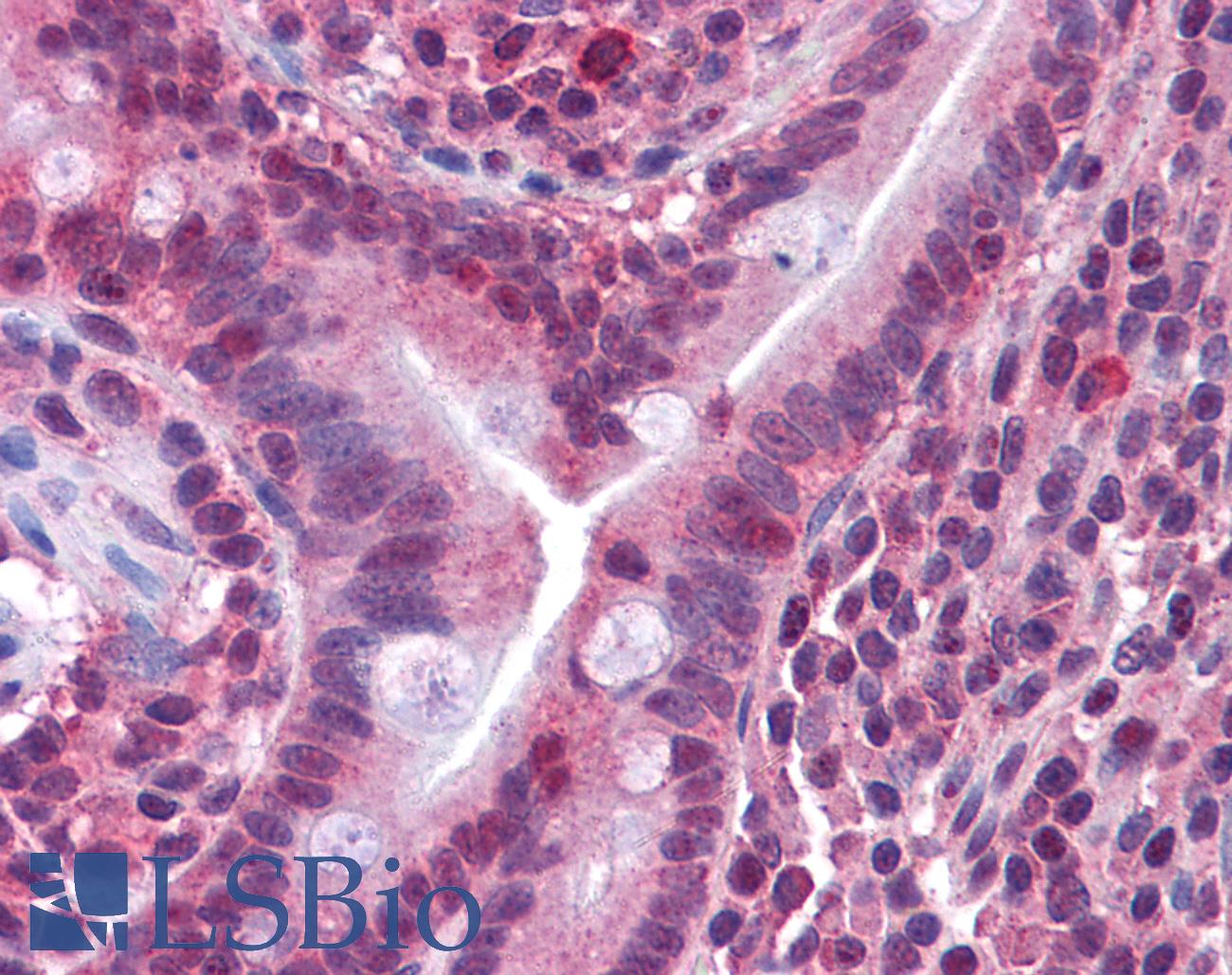 CACNG5 Antibody - Anti-CACNG5 antibody IHC of human small intestine. Immunohistochemistry of formalin-fixed, paraffin-embedded tissue after heat-induced antigen retrieval. Antibody concentration 10 ug/ml.