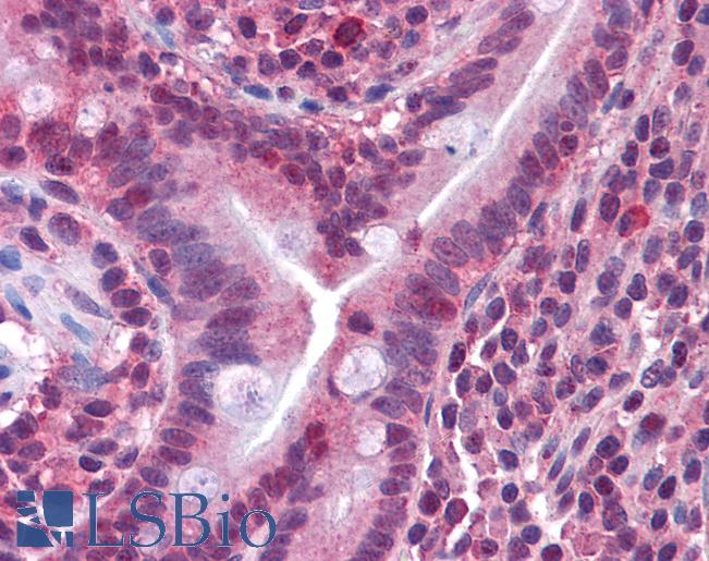CACNG5 Antibody - Anti-CACNG5 antibody IHC of human small intestine. Immunohistochemistry of formalin-fixed, paraffin-embedded tissue after heat-induced antigen retrieval. Antibody concentration 10 ug/ml.