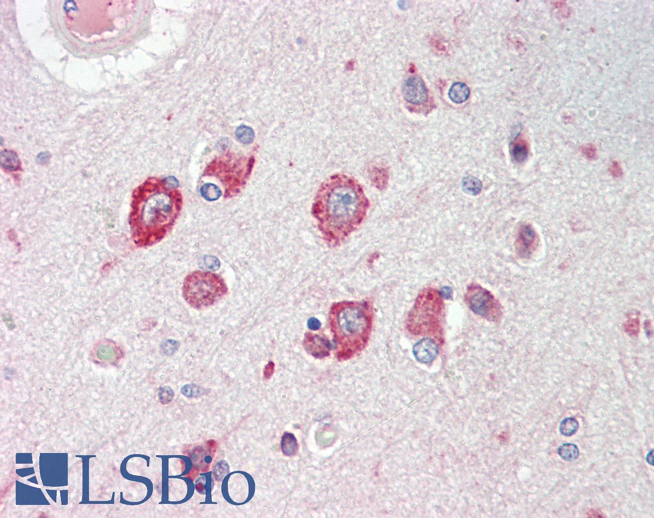 CACNG8 Antibody - Anti-CACNG8 antibody IHC staining of human brain, cortex. Immunohistochemistry of formalin-fixed, paraffin-embedded tissue after heat-induced antigen retrieval.