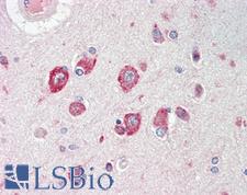 CACNG8 Antibody - Anti-CACNG8 antibody IHC staining of human brain, cortex. Immunohistochemistry of formalin-fixed, paraffin-embedded tissue after heat-induced antigen retrieval.