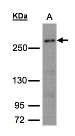 CAD Antibody - Sample (30g whole cell lysate). A:293T whole cell lysate. 5% SDS PAGE. CAD antibody diluted at 1:1500