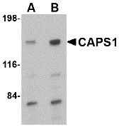 CADPS Antibody - Western blot of CAPS1 in rat brain tissue lysate with CAPS1 antibody at (A) 0.5 and (B) 1 ug/ml.