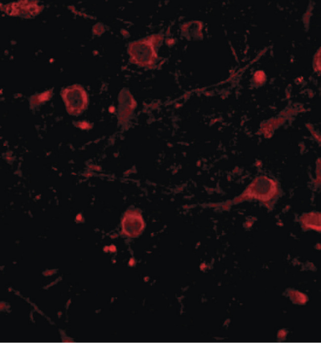 CADPS Antibody - Immunofluorescence of CAPS1 in human brain tissue with CAPS1 antibody at 20 ug/ml.