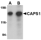 CADPS Antibody - Western blot of CAPS1 in rat brain tissue lysate with CAPS1 antibody at (A) 0.25 and (B) 0.5 ug/ml.