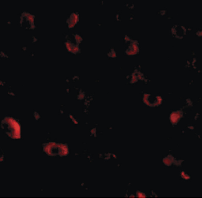 CADPS Antibody - Immunofluorescence of CAPS1 in human brain tissue with CAPS1 antibody at 20 ug/ml.