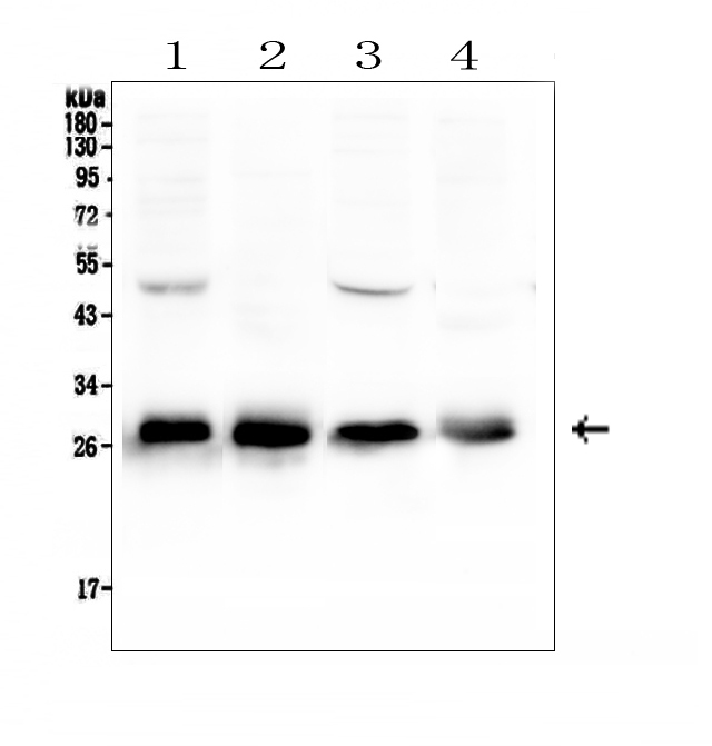 CALB1 / Calbindin Antibody - Western blot analysis of Calbindin using anti-Calbindin antibody. Electrophoresis was performed on a 5-20% SDS-PAGE gel at 70V (Stacking gel) / 90V (Resolving gel) for 2-3 hours. The sample well of each lane was loaded with 50ug of sample under reducing conditions. Lane 1: rat brain tissue lysates,Lane 2: rat kidney tissue lysates,Lane 3: mouse brain tissue lysates,Lane 4: mouse kidney tissue lysates. After Electrophoresis, proteins were transferred to a Nitrocellulose membrane at 150mA for 50-90 minutes. Blocked the membrane with 5% Non-fat Milk/ TBS for 1.5 hour at RT. The membrane was incubated with rabbit anti-Calbindin antigen affinity purified polyclonal antibody at 0.5 µg/mL overnight at 4°C, then washed with TBS-0.1% Tween 3 times with 5 minutes each and probed with a goat anti-rabbit IgG-HRP secondary antibody at a dilution of 1:10000 for 1.5 hour at RT. The signal is developed using an Enhanced Chemiluminescent detection (ECL) kit with Tanon 5200 system. A specific band was detected for Calbindin at approximately 28KD. The expected band size for Calbindin is at 30KD.