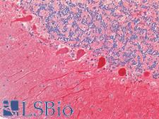CALB1 / Calbindin Antibody - Human Brain, Cerebellum: Formalin-Fixed, Paraffin-Embedded (FFPE)