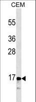 CALCA Antibody - CALCA/CT Antibody western blot of CEM cell line lysates (35 ug/lane). The CALCA/CT antibody detected the CALCA/CT protein (arrow).